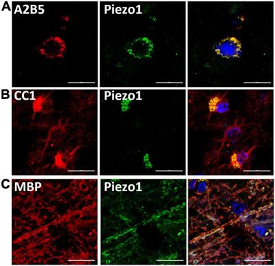 Mechanoreceptor Piezo1 Is Downregulated in Multiple Sclerosis Brain and Is Involved in the Maturation and Migration of Oligodendrocytes in vitro